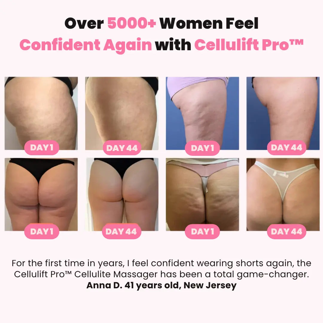 Cellulift Pro™ Cellulite Cupping Massager