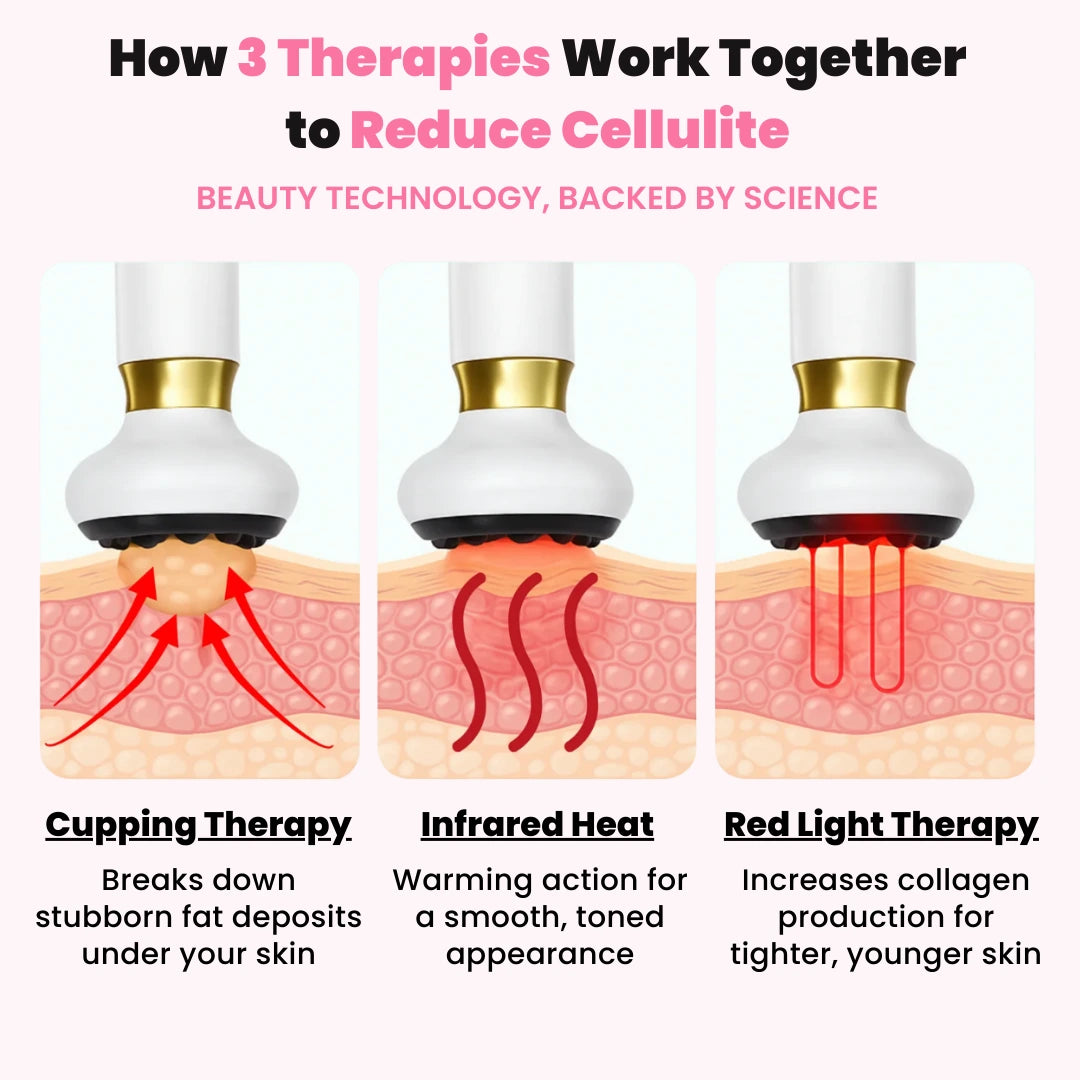 Cellulift Pro™ Cellulite Cupping Massager
