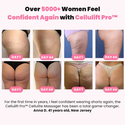 Cellulift Pro™  Cellulite Cupping Massager