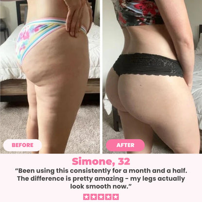 Cellulift Pro™  Cellulite Cupping Massager